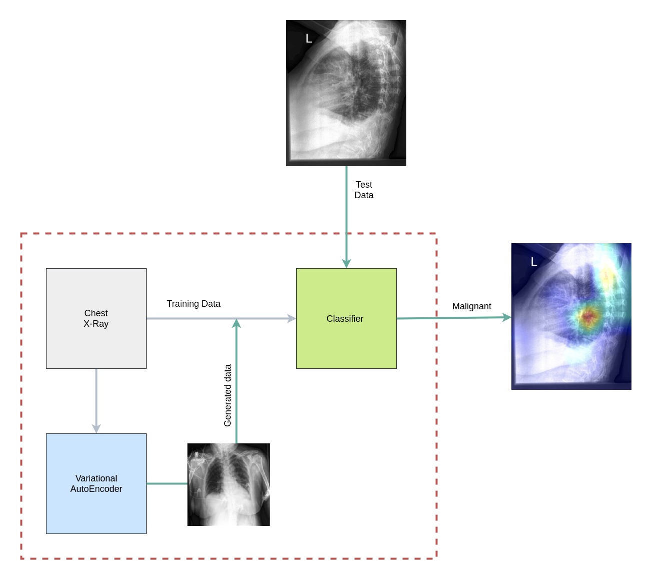 lung cancer prediction using machine learning research paper